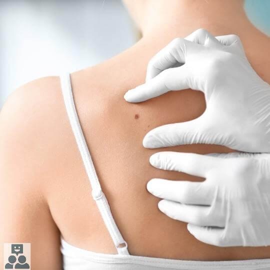 Rug met moedervlek van een vrouw wat wordt gecontroleerd - Ik Wil Therapie -